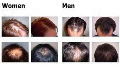Organic Hair Growth Essence - Timothy Lane